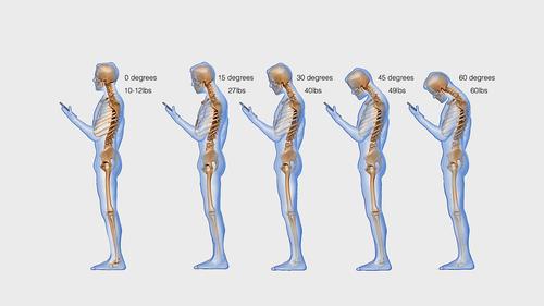 Looking down at your smartphone exerts 27kg on your neck