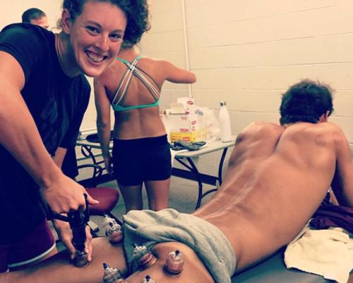 Olympic athletes raise profile of cupping