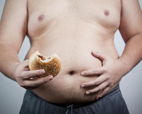 The study concludes that obesity is a leading factor in around 4 per cent of all worldwide cancer cases
