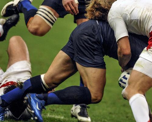 Rugby is one sport that has started taking action on concussion