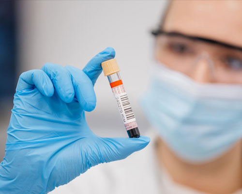 Research: Killer cells