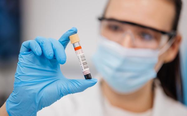 Half an hour of exercise boosts cancer-killing white blood cells / photo: Shutterstock/wedmoments.stock
