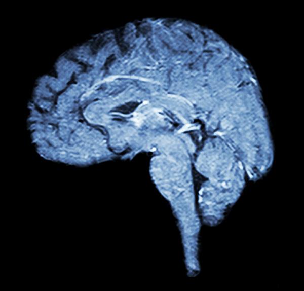 Brain activity was measured in 51 people / Puwadol Jaturawutthichai/shutterstock.com