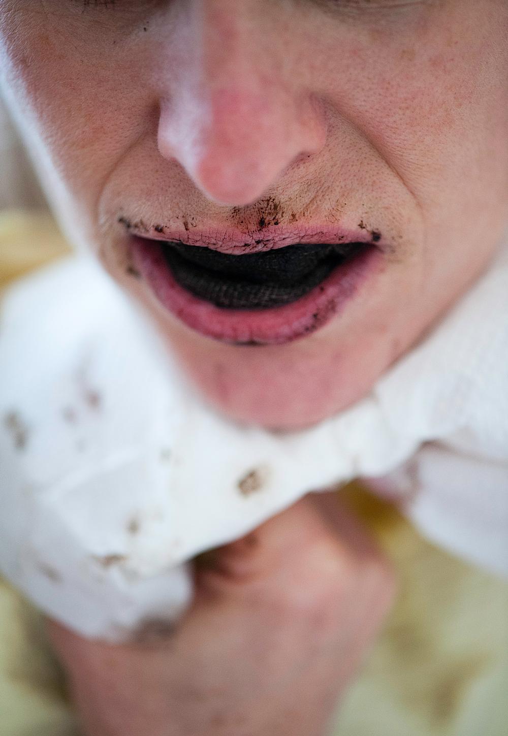 A mud gum treatment in Lithuania