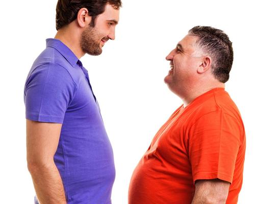 discovered that an overweight person at 50 years old had a comparable white matter volume to a lean person aged 60 years, implying a difference in brain age of 10 years / Shutterstock/Jinga